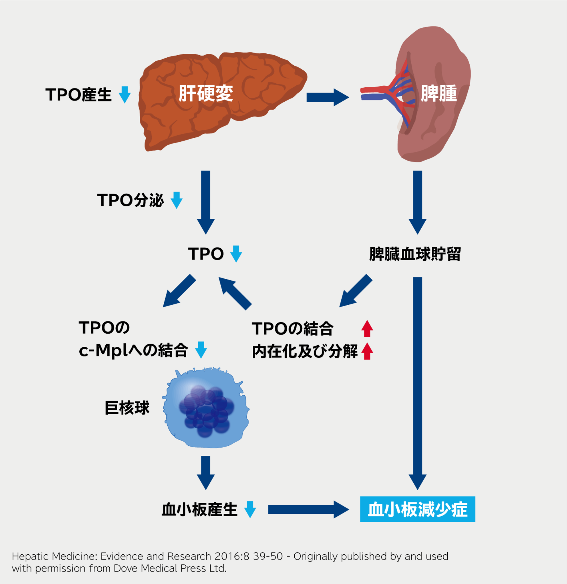 肝硬変における血小板減少症