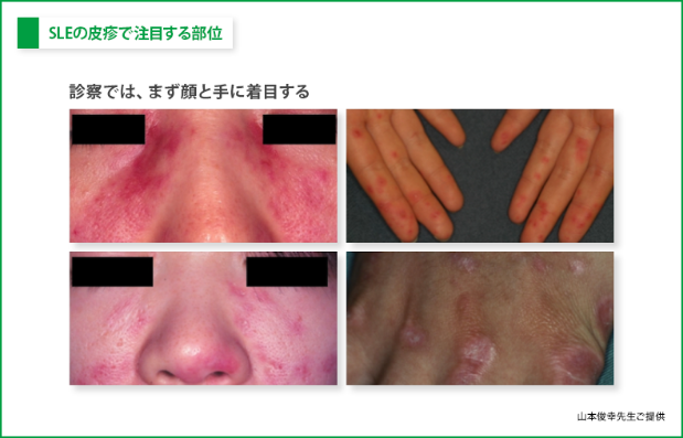 患者はどのような影響を受けますか?