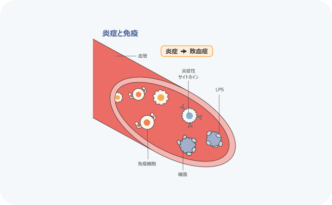 炎症と免疫